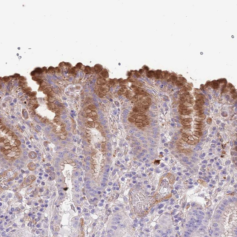 Anti-ABHD17C Antibody
