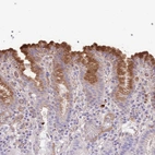 Anti-ABHD17C Antibody