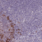 Immunohistochemical staining of human tonsil shows moderate positivity in a subset of non-germinal center cells.