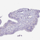 Immunohistochemical staining of human fallopian tube shows very weak cytoplasmic positivity in glandular cells.