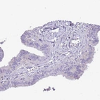 Immunohistochemical staining of human fallopian tube shows very weak cytoplasmic positivity in glandular cells.