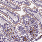 Immunohistochemical staining of human small intestine shows moderate positivity in leukocytes.