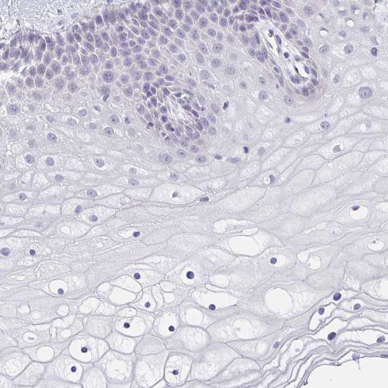 Anti-CACNA1S Antibody
