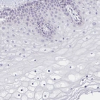 Anti-CACNA1S Antibody