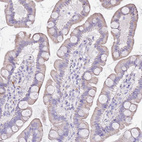 Immunohistochemical staining of human gastrointestinal shows moderate cytoplasmic positivity in glandular cells.