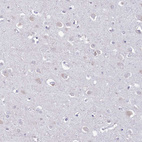 Immunohistochemical staining of human cerebral cortex shows very weak positivity in neurons.