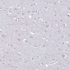 Immunohistochemical staining of human cerebral cortex shows very weak positivity in neurons.