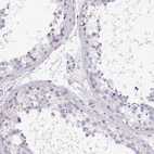 Immunohistochemical staining of human testis shows no positivity in cells in seminiferous ducts as expected.