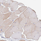 Immunohistochemical staining of human skeletal muscle shows negative to very weak positivity in myocytes as expected