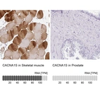 Immunohistochemistry analysis in human skeletal muscle and prostate tissues using HPA048892 antibody. Corresponding CACNA1S RNA-seq data are presented for the same tissues.