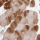 Immunohistochemical staining of human skeletal muscle shows strong cytoplasmic positivity in myocytes.
