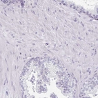 Immunohistochemical staining of human prostate shows no positivity in smooth muscle cells as expected.