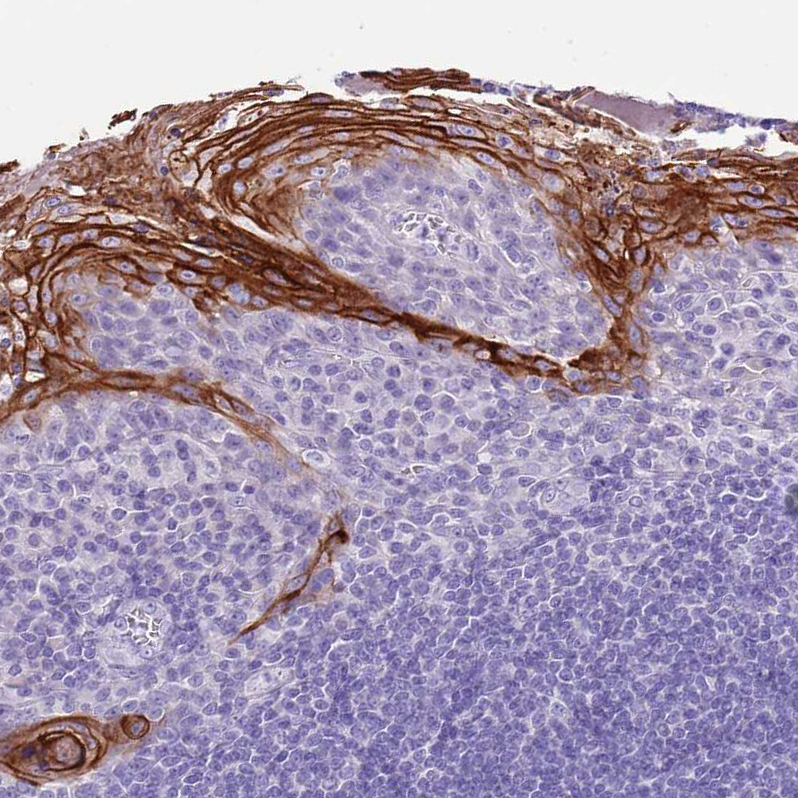 Anti-TBC1D10B Antibody