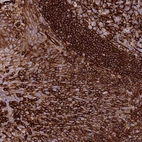 Anti-KBTBD6 Antibody