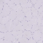 Immunohistochemical staining of human skeletal muscle shows no positivity in myocytes as expected.