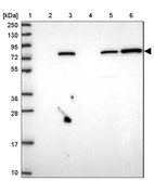 Lane 1: Marker [kDa] 250, 130, 95, 72, 55, 36, 28, 17, 10_br/_Lane 2: Human cell line RT-4_br/_Lane 3: Human cell line U-251MG sp_br/_Lane 4: Human plasma (IgG/HSA depleted)_br/_Lane 5: Human liver tissue_br/_Lane 6: Human tonsil tissue