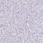 Immunohistochemical staining of human liver shows no positivity in hepatocytes as expected.