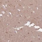 Anti-EMC1 Antibody