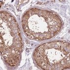 Immunohistochemical staining of human testis shows moderate granular cytoplasmic positivity in cells in seminiferous ducts.