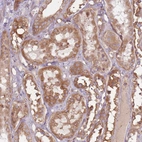 Immunohistochemical staining of human kidney shows moderate granular cytoplasmic positivity in cells in tubules.