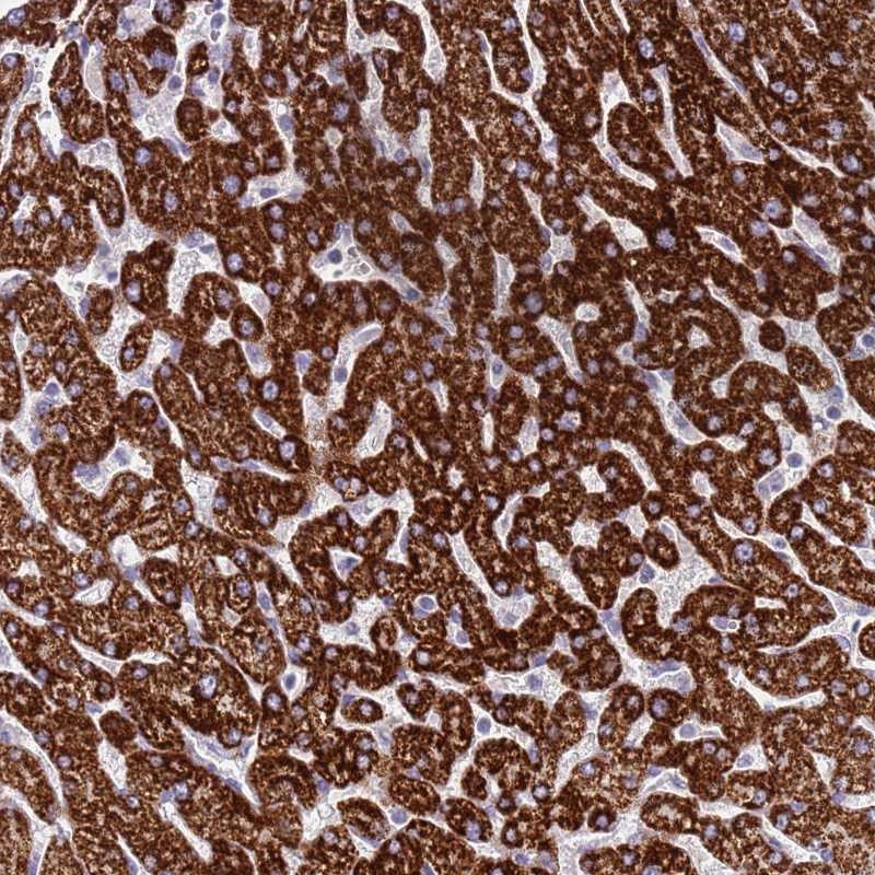 Anti-RNF222 Antibody