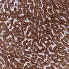 Anti-RNF222 Antibody