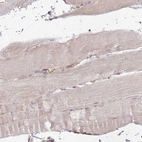 Immunohistochemical staining of human skeletal muscle shows very weak positivity in myocytes.