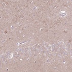 Anti-LRFN3 Antibody