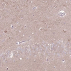 Anti-LRFN3 Antibody