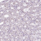 Anti-ZNF688 Antibody