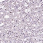Anti-ZNF688 Antibody