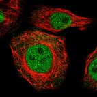 Immunofluorescent staining of human cell line MCF7 shows localization to nucleoplasm & cell junctions.