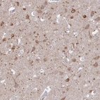 Immunohistochemical staining of human cerebral cortex shows high expression.