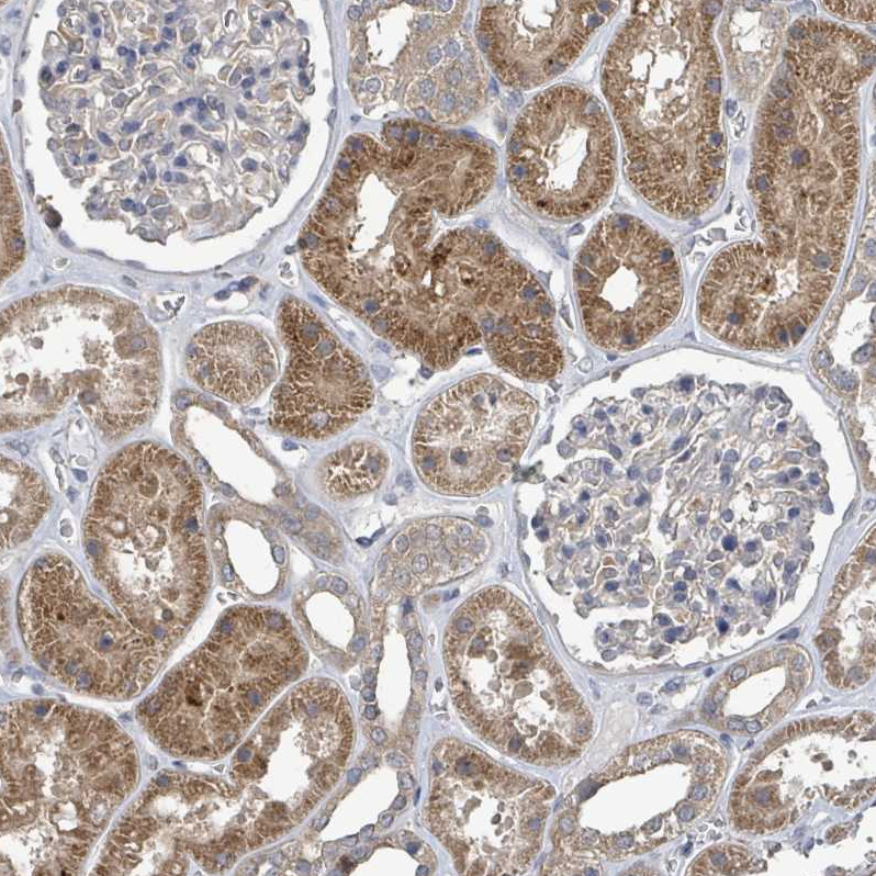 Anti-SLC9A7 Antibody