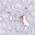 Anti-IGF1 Antibody