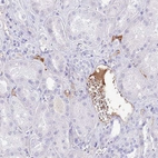 Immunohistochemical staining of human kidney shows moderate positivity in plasma.