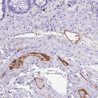 Immunohistochemical staining of human rectum shows moderate positivity in plasma.