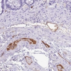 Immunohistochemical staining of human rectum shows moderate positivity in plasma.