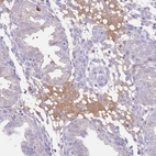 Immunohistochemical staining of human endometrium shows moderate in plasma.