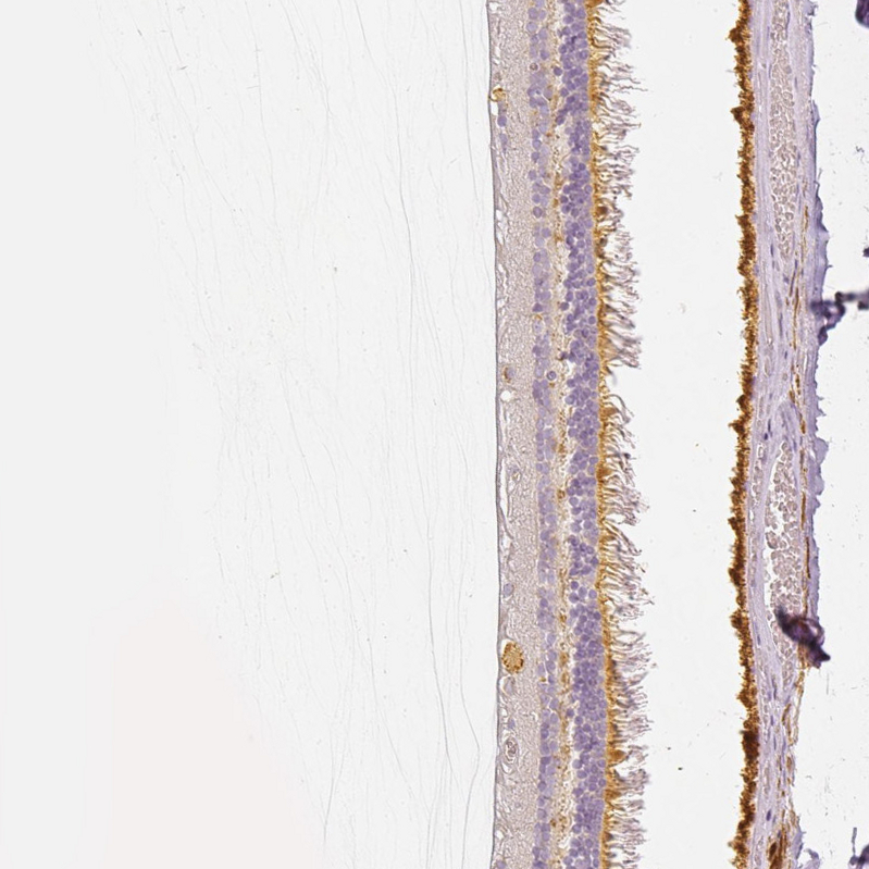 Anti-MYO3A Antibody