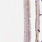 Anti-MYO3A Antibody