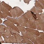Immunohistochemical staining of human skeletal muscle shows high expression.