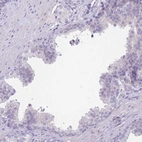 Immunohistochemical staining of human prostate shows low expression as expected.