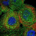 Immunofluorescent staining of human cell line A-431 shows localization to plasma membrane.