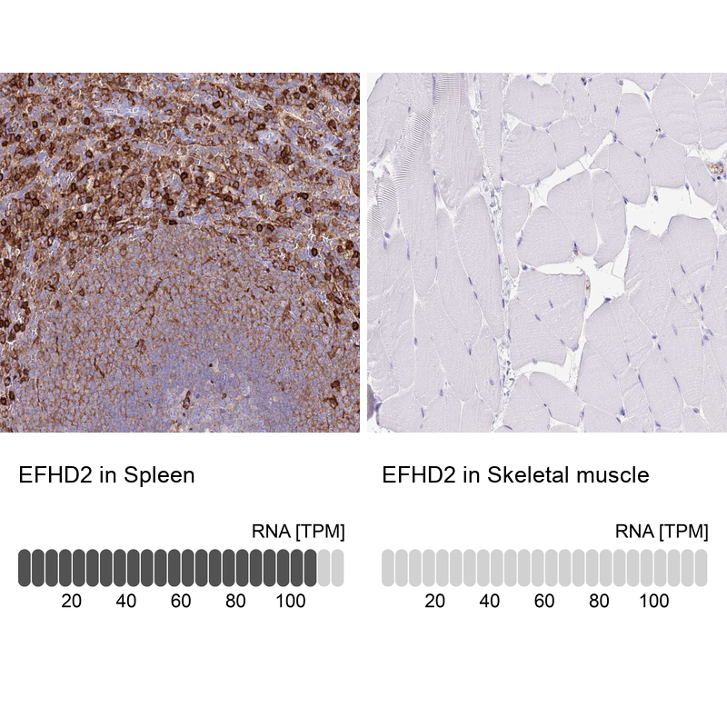 Rabbit Polyclonal Anti-EFHD2 Antibody - Buy for research - Highly ...