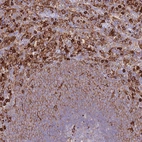 Immunohistochemical staining of human spleen shows strong membranous positivity in cells in red pulp.