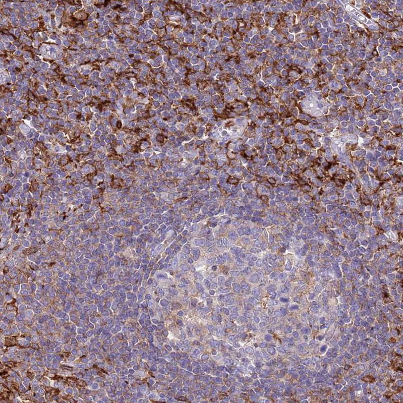 Rabbit Polyclonal Anti-EFHD2 Antibody - Buy for research - Highly ...