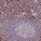 Immunohistochemical staining of human lymph node shows strong membranous positivity in non-germinal center cells.