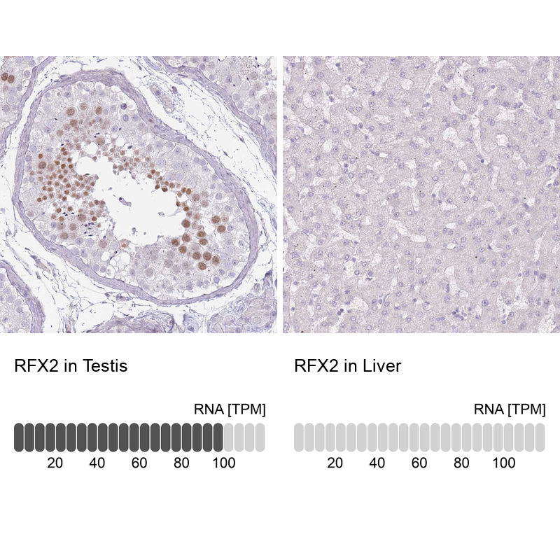 Anti-RFX2 Antibody