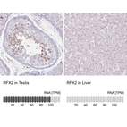 Anti-RFX2 Antibody